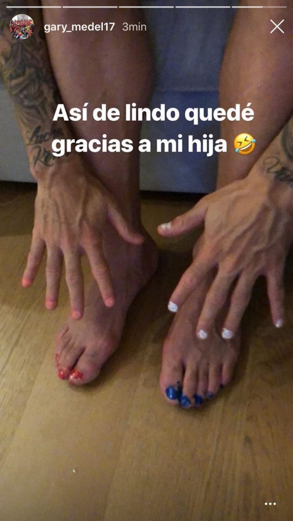 Gary Medel 2