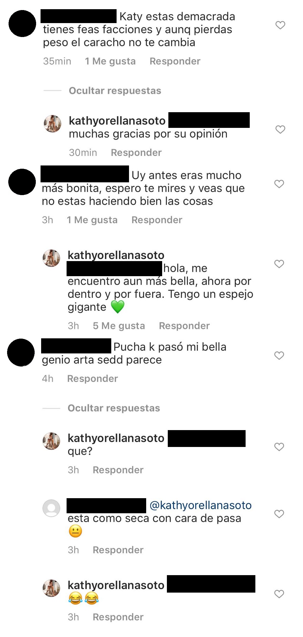 Kathy Orellana Duros Comentarios Por Su Aspecto