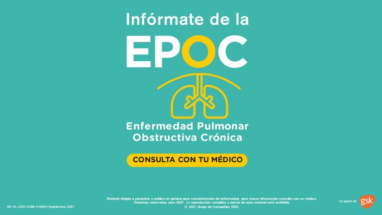 Epoc