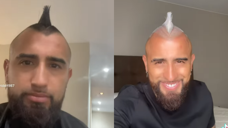 Arturo Vidal Look