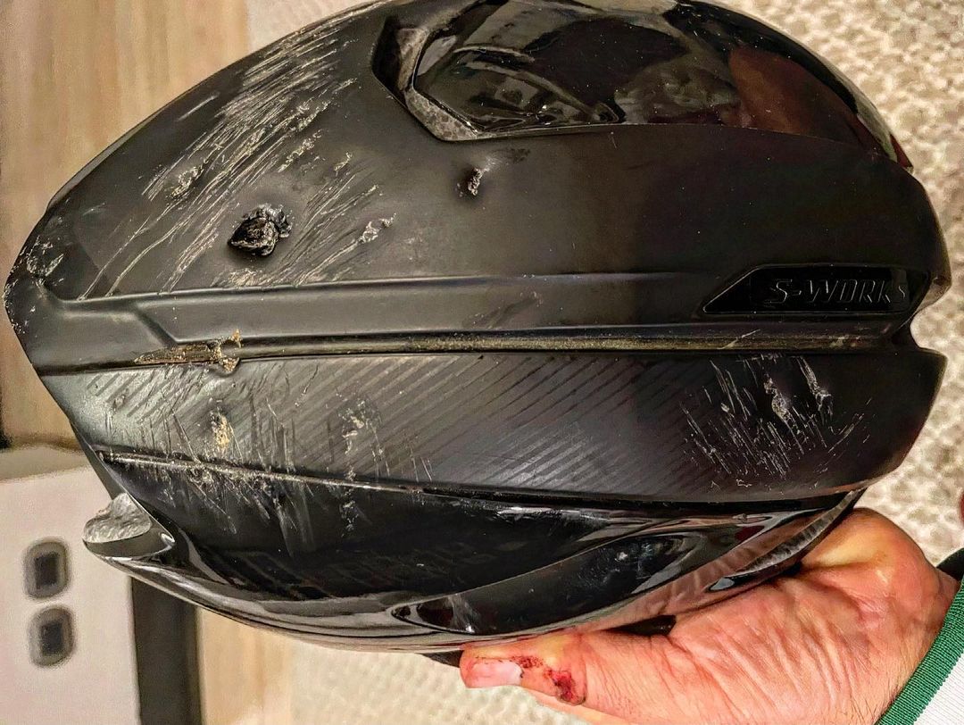 Casco Del Accidente