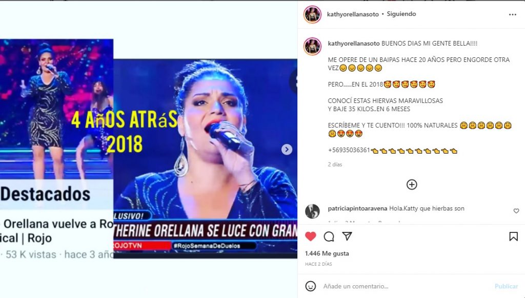 Kathy Orellana Y Su Increíble Cambio