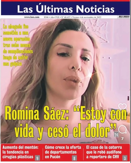 Romina Sáez Brutal Golpiza