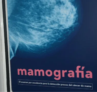 Mamografías (1)