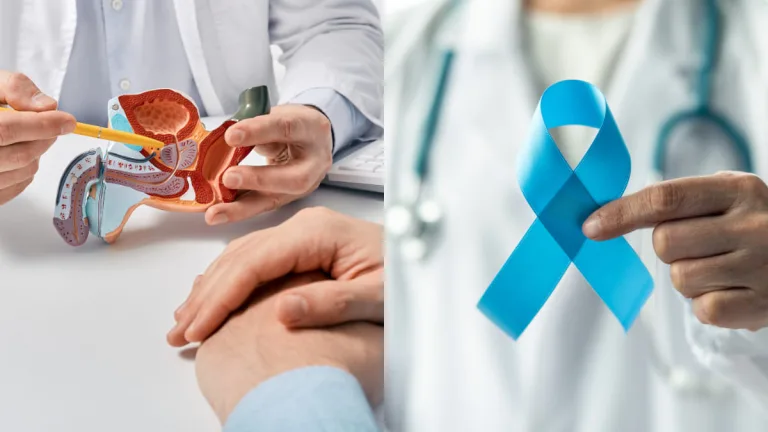 Cancer De Prostata