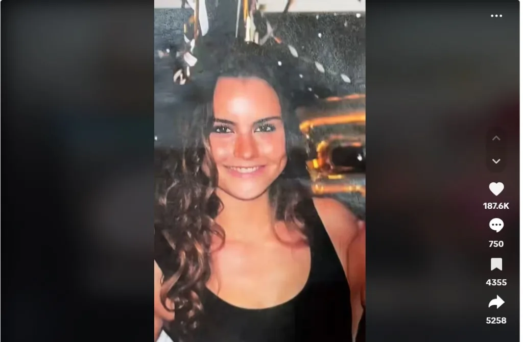 La ex Miss Chile Emilia Dides niega cirugía en su cara
