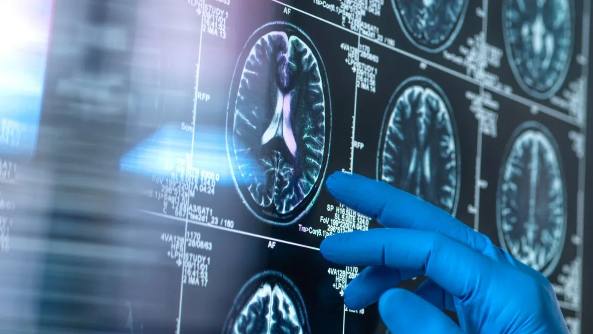 Conocida comediante chilena sufre accidente cerebrovascular y es internada de urgencia