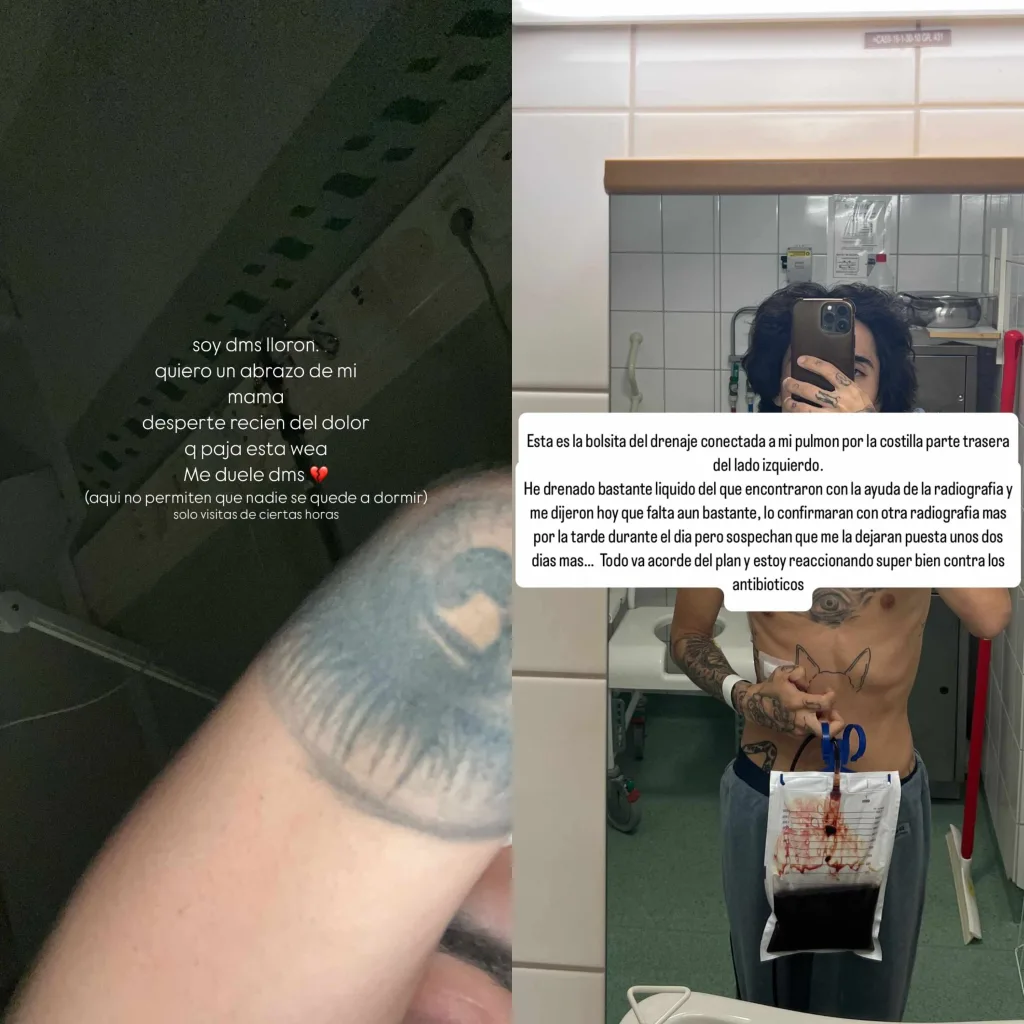 Leo Méndez Instagram cirugía de pulmón