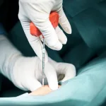 Cáncer