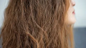 Frizz