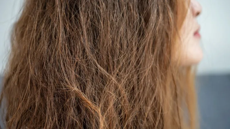 Frizz