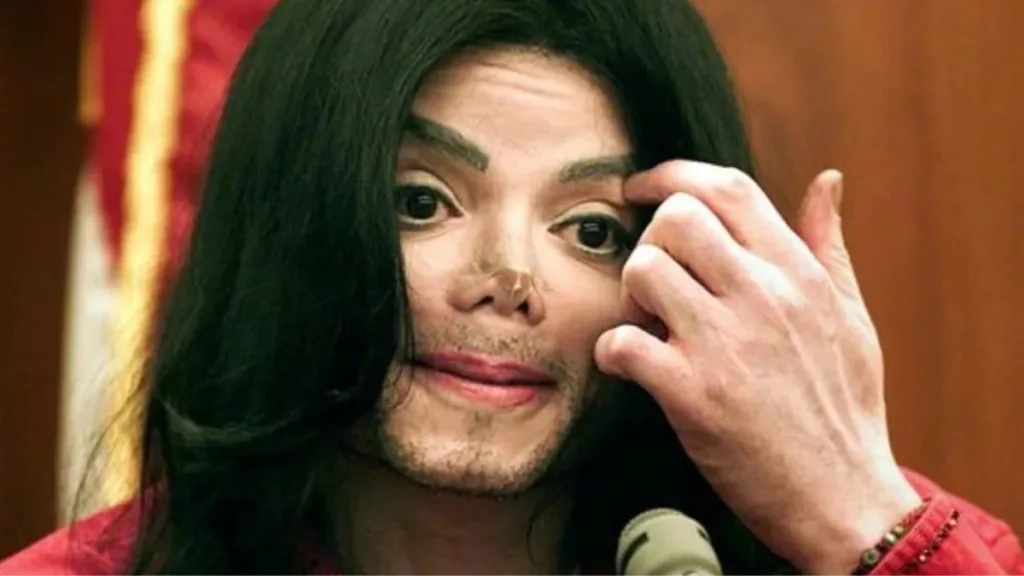 Michael Jackson, necrosis en la nariz