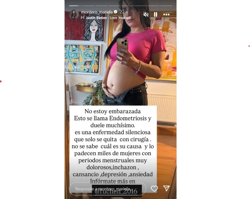 Mariela Montero padece endometriosis