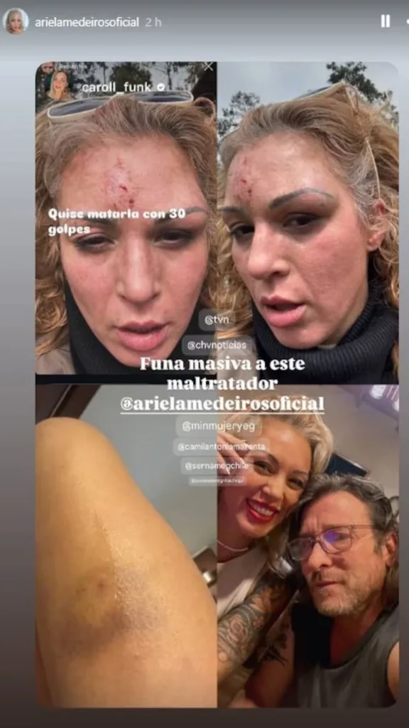 La ex Mekano, Ariela Medeiros, denuncia agresión y violencia por parte de su pareja.