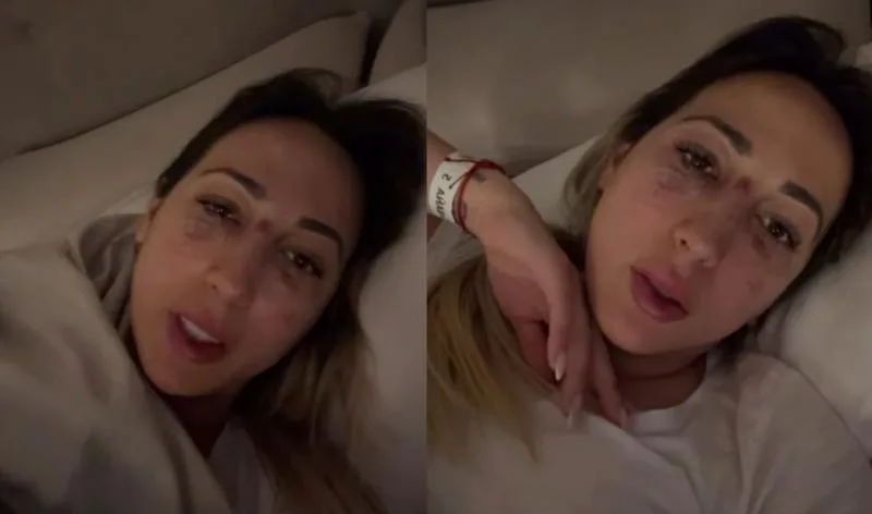 Influencer Rebeca Naranjo, pareja de Nano Calderón, sufre accidente en motocicleta