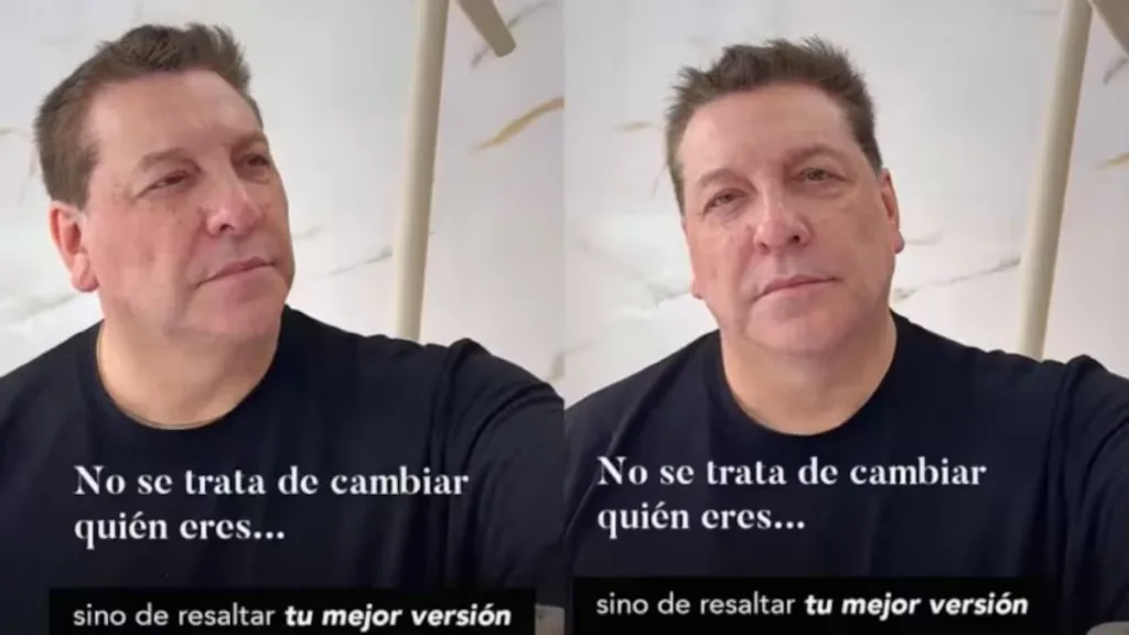 Julio César Rodríguez se realiza procedimiento estético facial