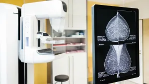 cáncer de mama y mamografía