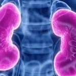 donación de riñón