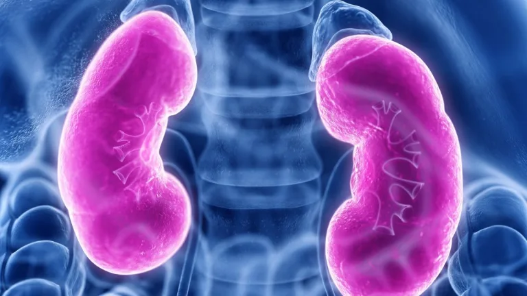 donación de riñón