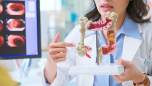 Cáncer de colon