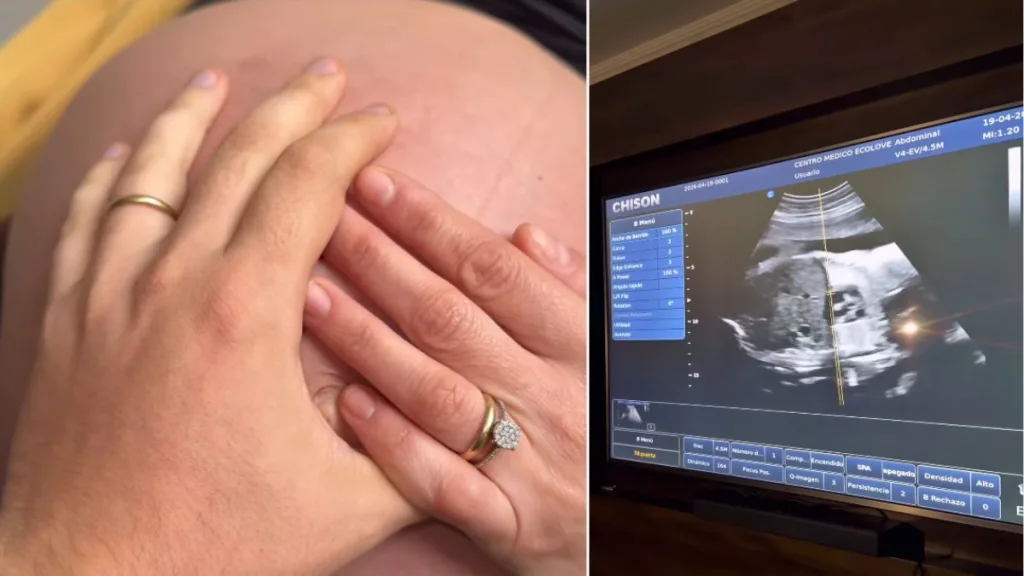 Exchica Reality Wilma González