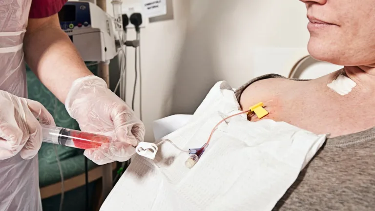 Cáncer En Chile Quimioterapia