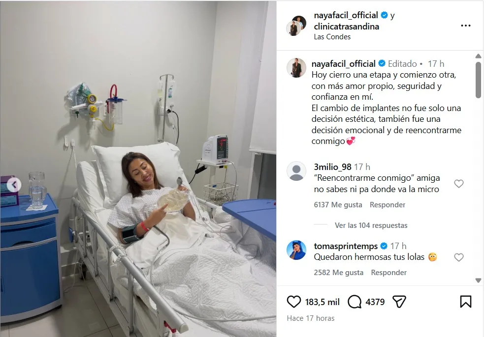 Naya Fácil Se Realiza Reducción Mamaria