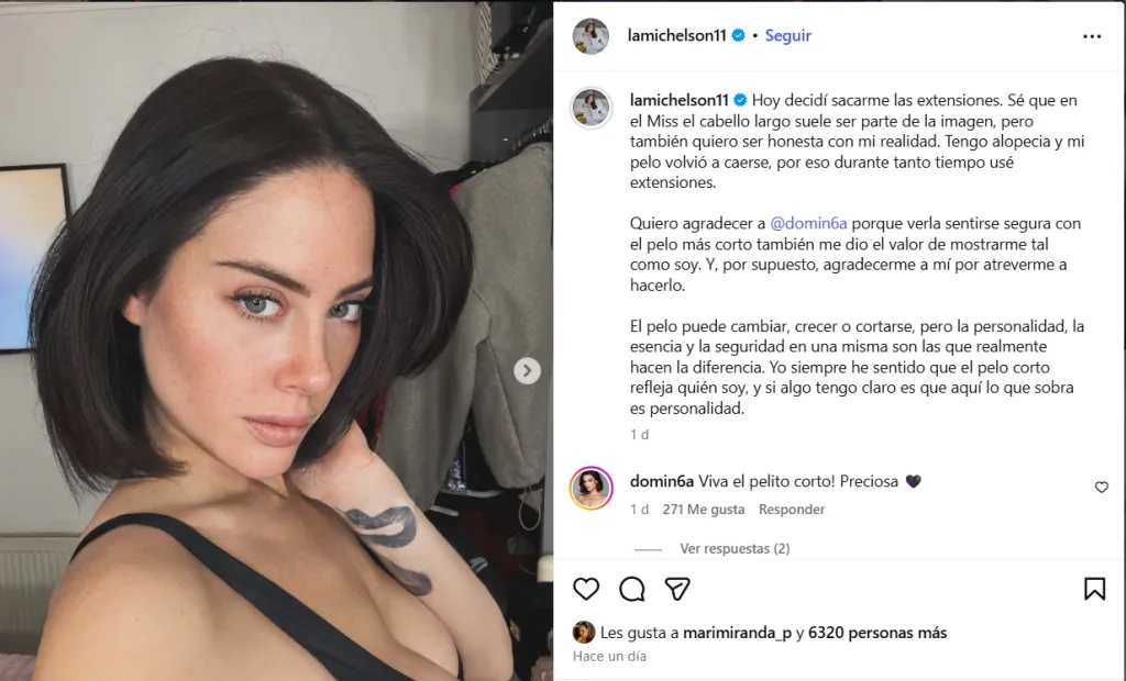 Nacha Michelson Revela Que Padece Alopecia