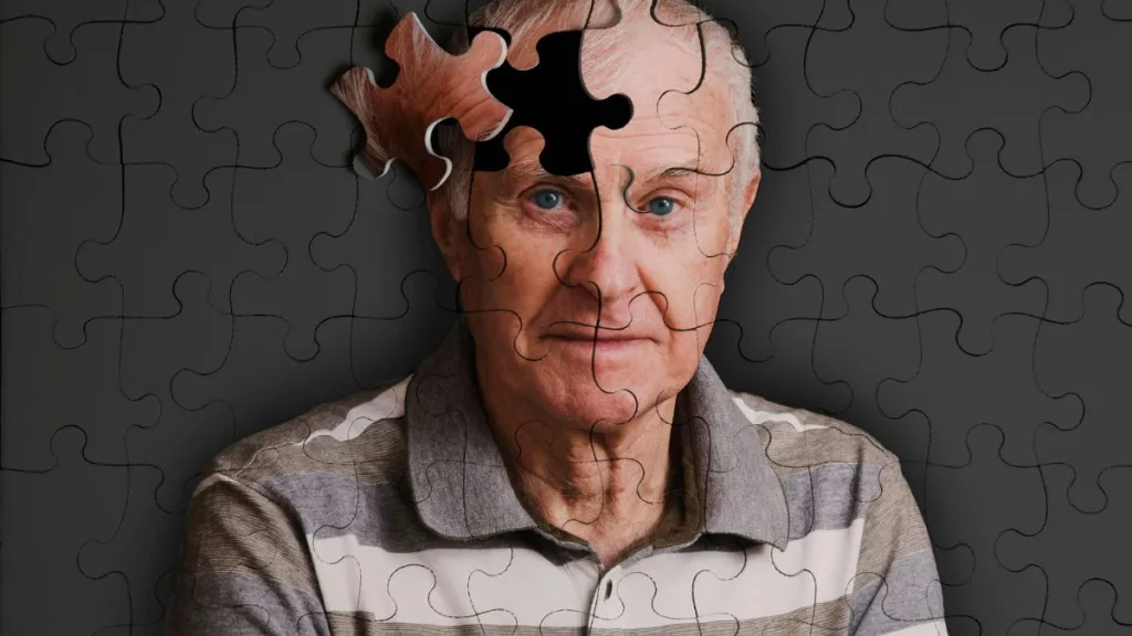Alzheimer En Chile