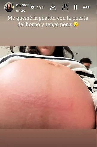 Gianella Marengo Lesión Durante Su Embarazo