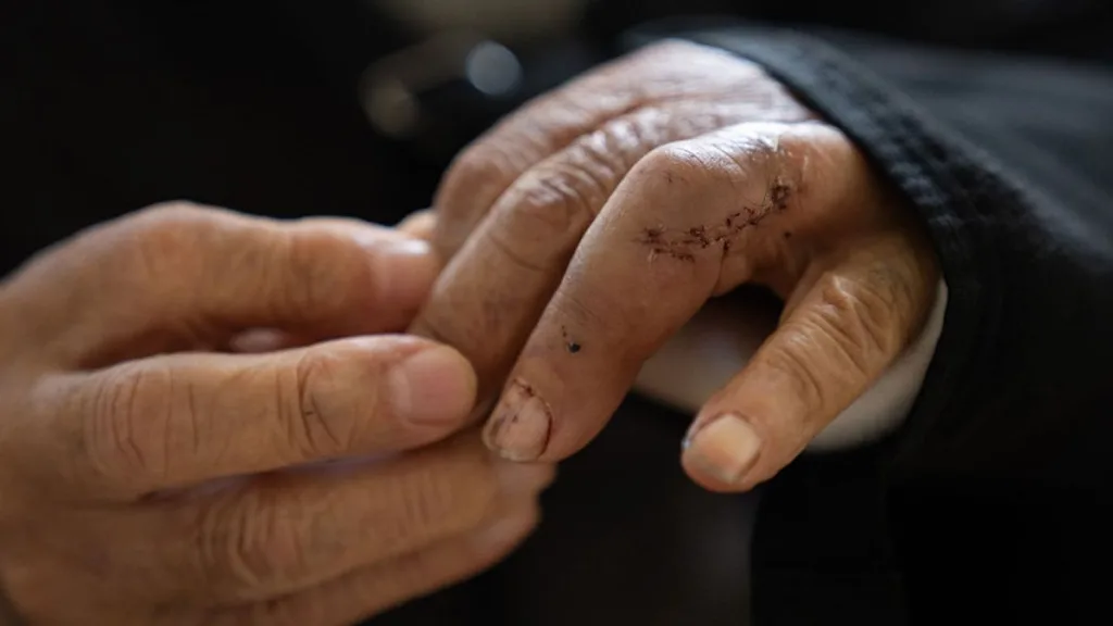 Adulto Mayor Lesiones Heridas